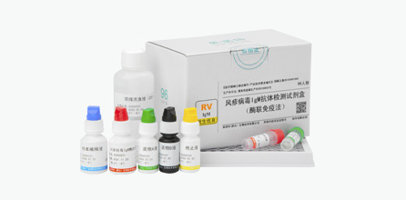 风疹病毒IgM抗体检测试剂盒（酶联免疫法）