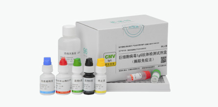 巨细胞病毒IgG抗体检测试剂盒（酶联免疫法）