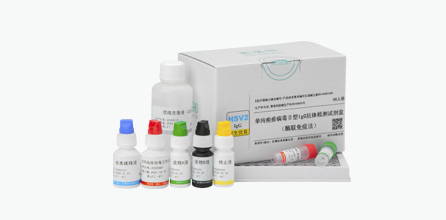 单纯疱疹病毒II型IgG抗体检测试剂盒（酶联免疫法）